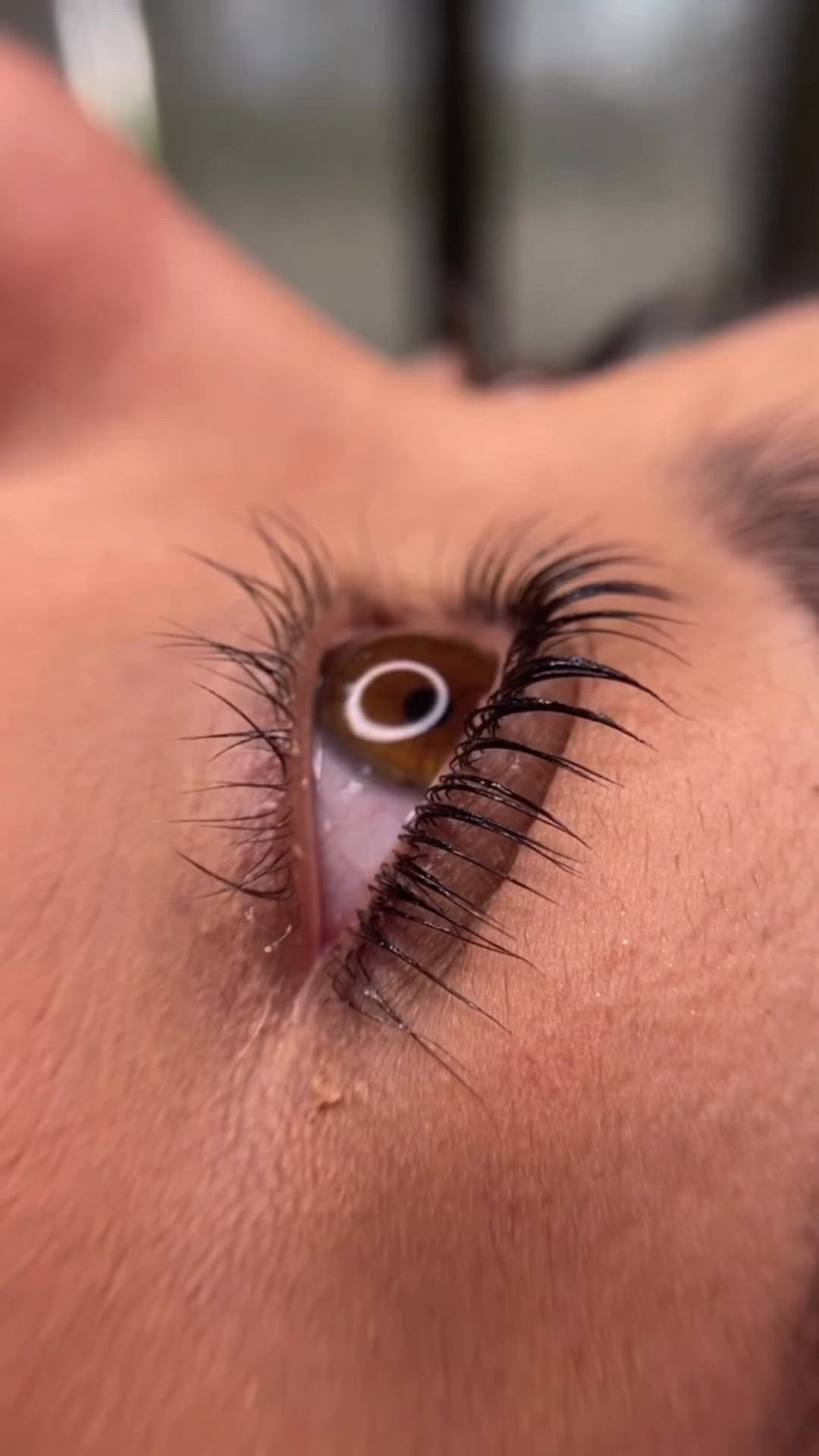 Vergleich von Microdermabrasion und Microneedling als moderne Anti-Aging-Behandlungen