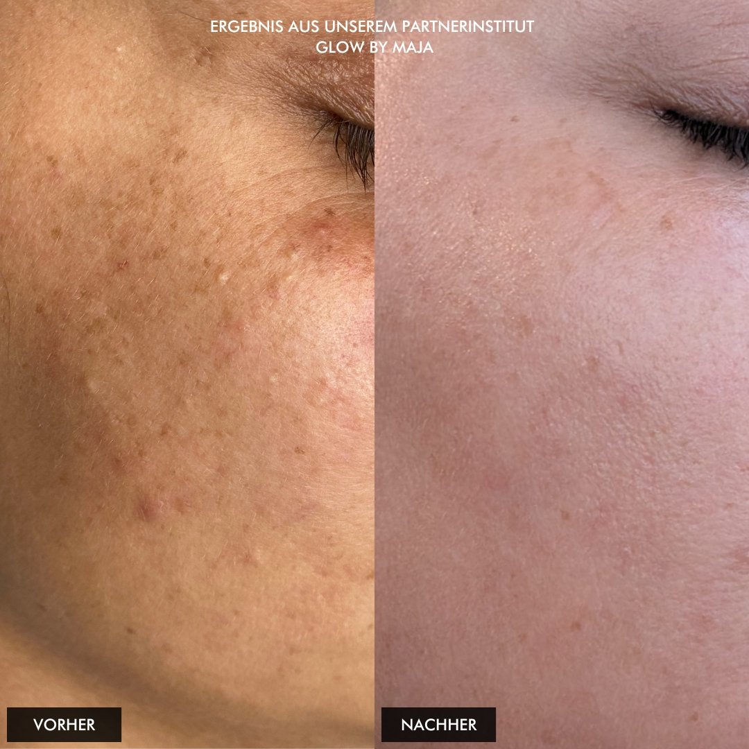 UNTERLAGERUNGEN (2).jpg